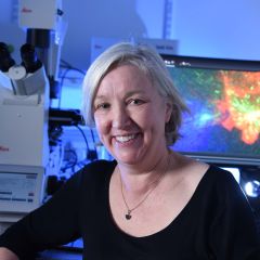 Gillian Griffiths, a smiling woman with short blond hair and a black top. She is in a low lit lab with a microscope and a computer behind her.